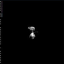 Mouth of the Architect / Kenoma Split LP [Gilead]